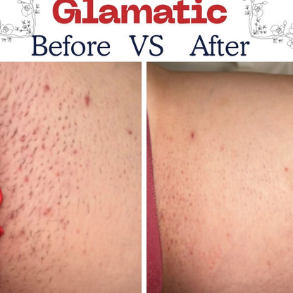 Ingrown Hair Smoothing Solution