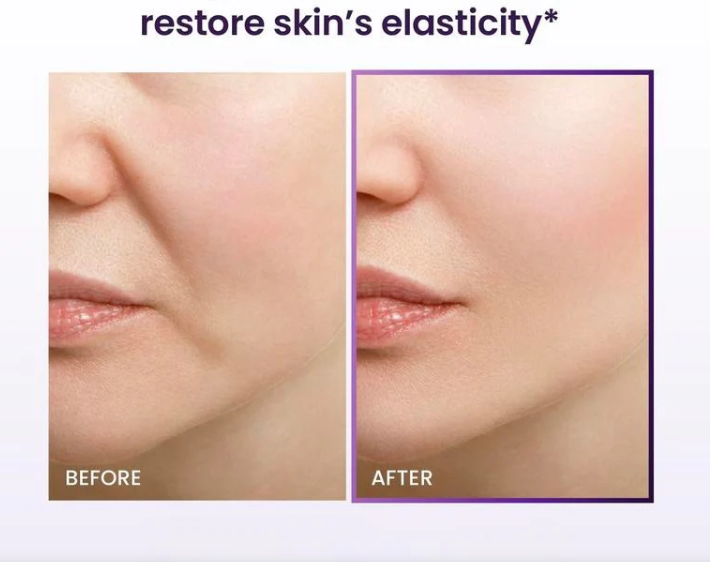 Glamatic Probioderm Lifting Cream